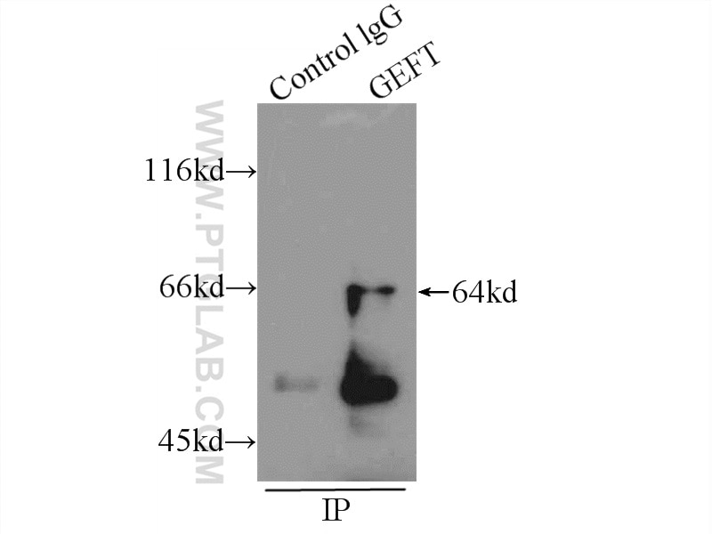 Immunoprecipitation (IP) experiment of HEK-293 cells using GEFT Polyclonal antibody (17028-1-AP)
