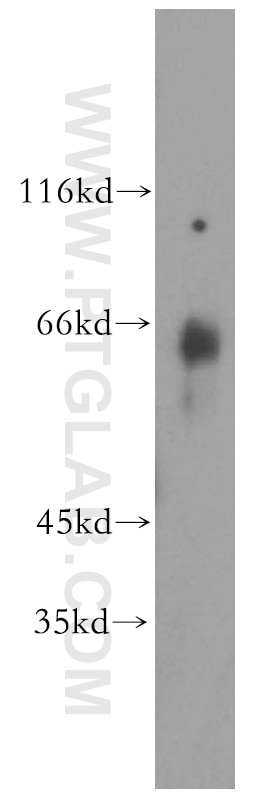 Western Blot (WB) analysis of human brain tissue using GEFT Polyclonal antibody (17028-1-AP)