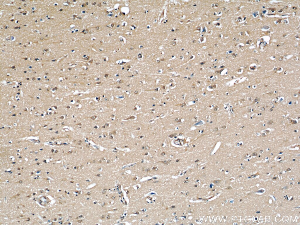 IHC staining of human brain using 66012-1-Ig