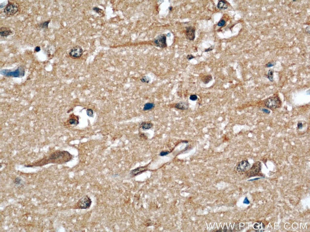 Immunohistochemistry (IHC) staining of human brain tissue using GEFT Monoclonal antibody (66012-1-Ig)