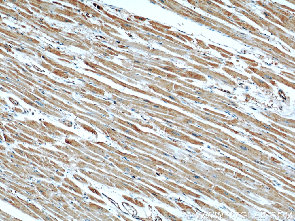 Immunohistochemistry (IHC) staining of human heart tissue using GEFT Monoclonal antibody (66012-1-Ig)