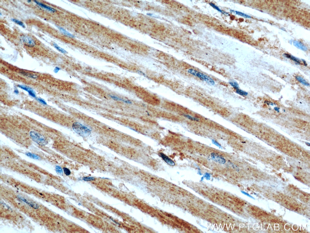 Immunohistochemistry (IHC) staining of human heart tissue using GEFT Monoclonal antibody (66012-1-Ig)