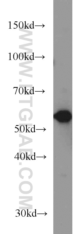 Western Blot (WB) analysis of human brain tissue using GEFT Monoclonal antibody (66012-1-Ig)