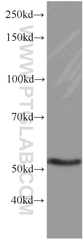 Western Blot (WB) analysis of human brain tissue using GEFT Monoclonal antibody (66012-1-Ig)