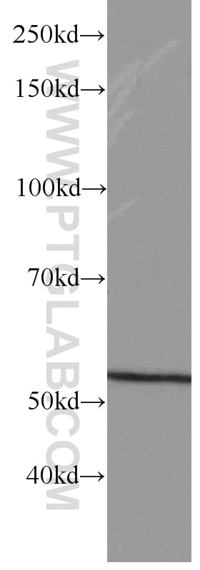 Western Blot (WB) analysis of mouse brain tissue using GEFT Monoclonal antibody (66012-1-Ig)