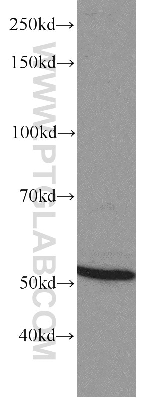 Western Blot (WB) analysis of rat brain tissue using GEFT Monoclonal antibody (66012-1-Ig)