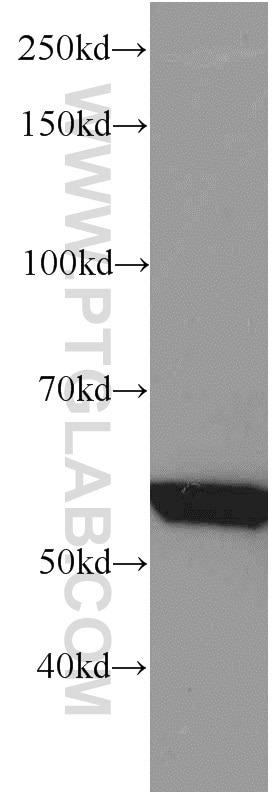 Western Blot (WB) analysis of mouse skeletal muscle tissue using GEFT Monoclonal antibody (66012-1-Ig)