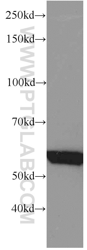 Western Blot (WB) analysis of mouse skeletal muscle tissue using GEFT Monoclonal antibody (66012-1-Ig)