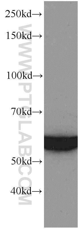 Western Blot (WB) analysis of rat skeletal muscle tissue using GEFT Monoclonal antibody (66012-1-Ig)