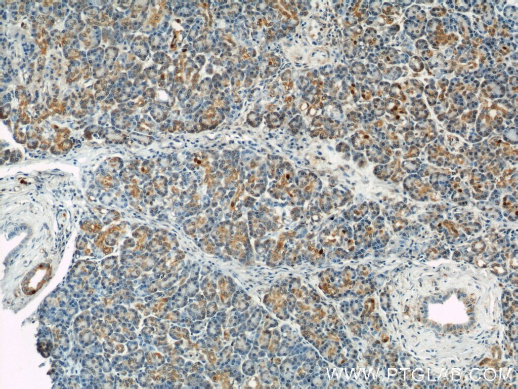 Immunohistochemistry (IHC) staining of human pancreas tissue using GEFT-Specific Polyclonal antibody (14839-1-AP)