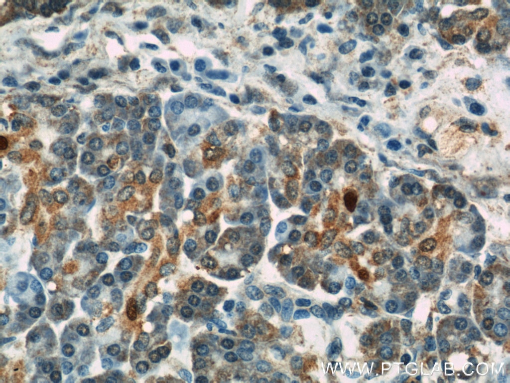 Immunohistochemistry (IHC) staining of human pancreas tissue using GEFT-Specific Polyclonal antibody (14839-1-AP)