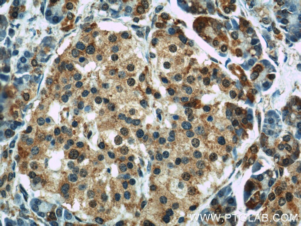 Immunohistochemistry (IHC) staining of human pancreas tissue using GEFT-Specific Polyclonal antibody (14839-1-AP)