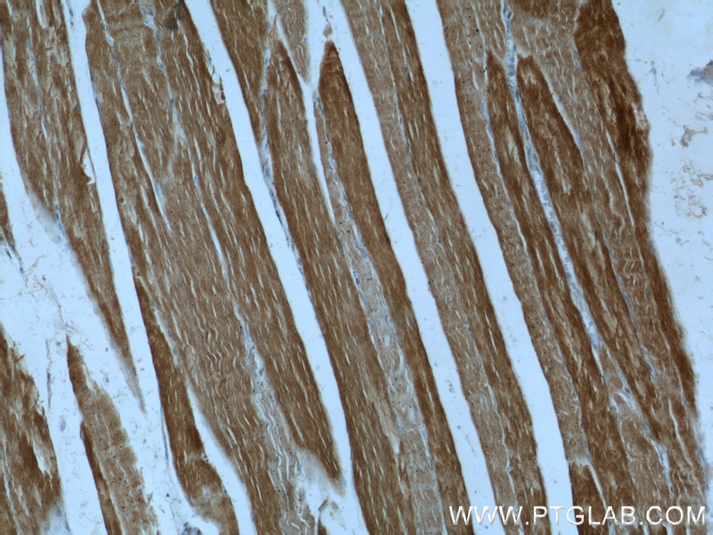 Immunohistochemistry (IHC) staining of human skeletal muscle tissue using GEFT-Specific Polyclonal antibody (14839-1-AP)