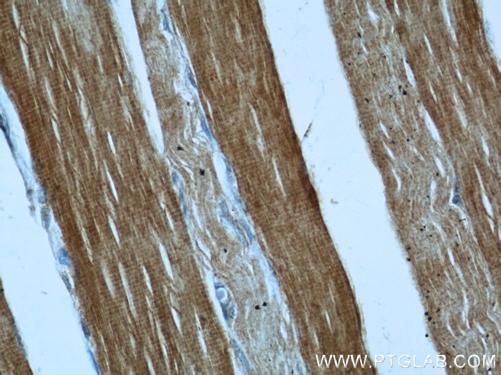 Immunohistochemistry (IHC) staining of human skeletal muscle tissue using GEFT-Specific Polyclonal antibody (14839-1-AP)