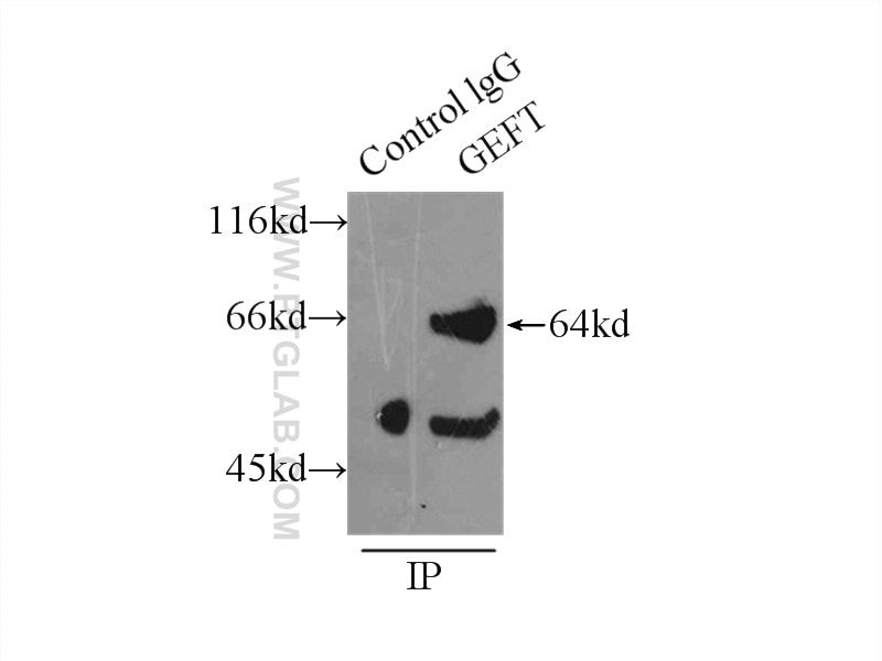 Immunoprecipitation (IP) experiment of mouse brain tissue using GEFT-Specific Polyclonal antibody (14839-1-AP)