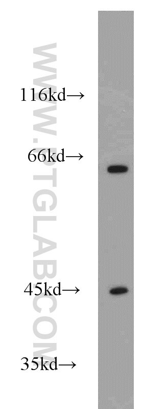 Western Blot (WB) analysis of mouse skeletal muscle tissue using GEFT-Specific Polyclonal antibody (14839-1-AP)