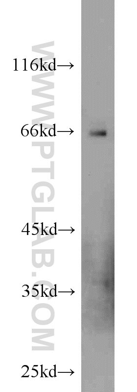 WB analysis of mouse liver using 14839-1-AP