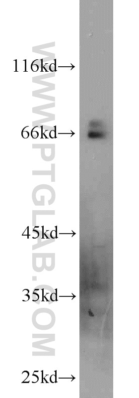 Western Blot (WB) analysis of mouse liver tissue using GEFT-Specific Polyclonal antibody (14839-1-AP)