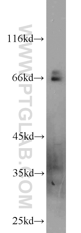 WB analysis of mouse liver using 14839-1-AP