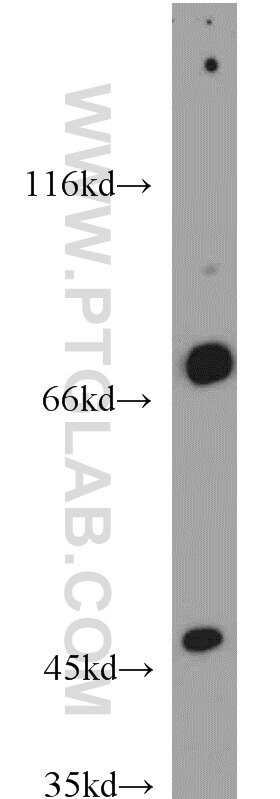 WB analysis of mouse skeletal muscle using 14839-1-AP