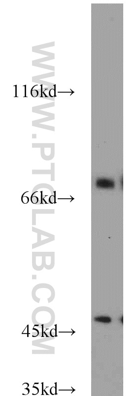 Western Blot (WB) analysis of mouse skeletal muscle tissue using GEFT-Specific Polyclonal antibody (14839-1-AP)