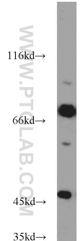 WB analysis of mouse skeletal muscle using 14839-1-AP