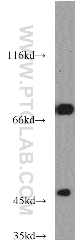 Western Blot (WB) analysis of mouse skeletal muscle tissue using GEFT-Specific Polyclonal antibody (14839-1-AP)