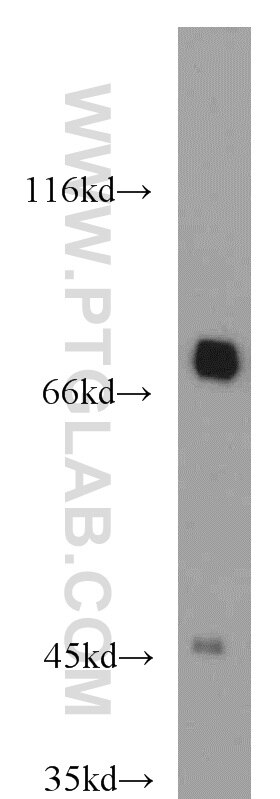 Western Blot (WB) analysis of mouse heart tissue using GEFT-Specific Polyclonal antibody (14839-1-AP)