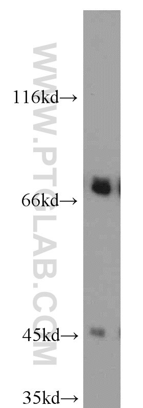 Western Blot (WB) analysis of mouse heart tissue using GEFT-Specific Polyclonal antibody (14839-1-AP)