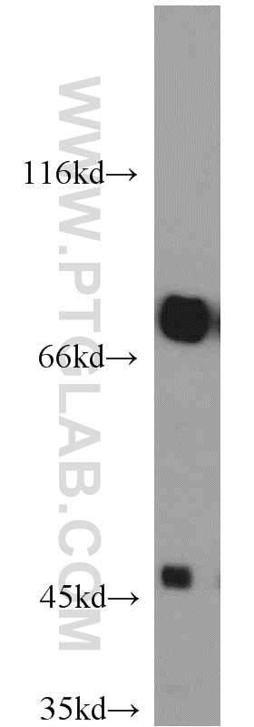 Western Blot (WB) analysis of mouse heart tissue using GEFT-Specific Polyclonal antibody (14839-1-AP)