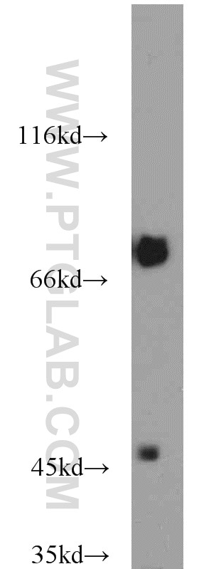 Western Blot (WB) analysis of mouse heart tissue using GEFT-Specific Polyclonal antibody (14839-1-AP)