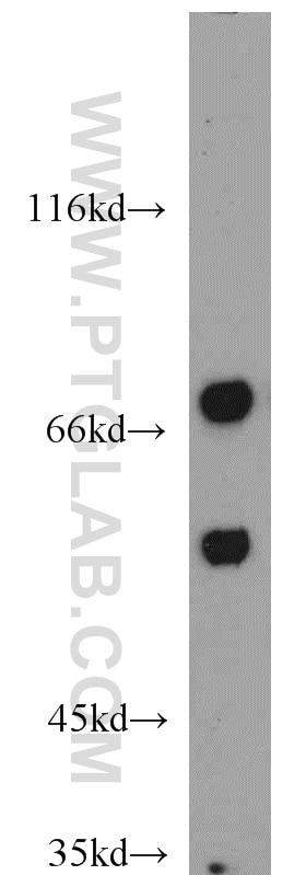 Western Blot (WB) analysis of HEK-293 cells using GEFT-Specific Polyclonal antibody (14839-1-AP)
