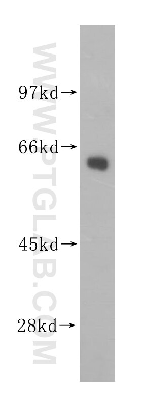 Western Blot (WB) analysis of mouse skeletal muscle tissue using GEFT-Specific Polyclonal antibody (14839-1-AP)