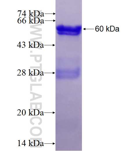 GEM fusion protein Ag4983 SDS-PAGE