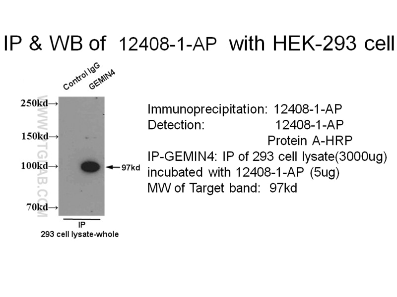 Immunoprecipitation (IP) experiment of HEK-293 cells using GEMIN4 Polyclonal antibody (12408-1-AP)