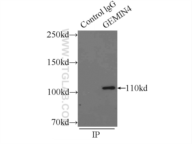 Immunoprecipitation (IP) experiment of HeLa cells using GEMIN4 Polyclonal antibody (12408-1-AP)