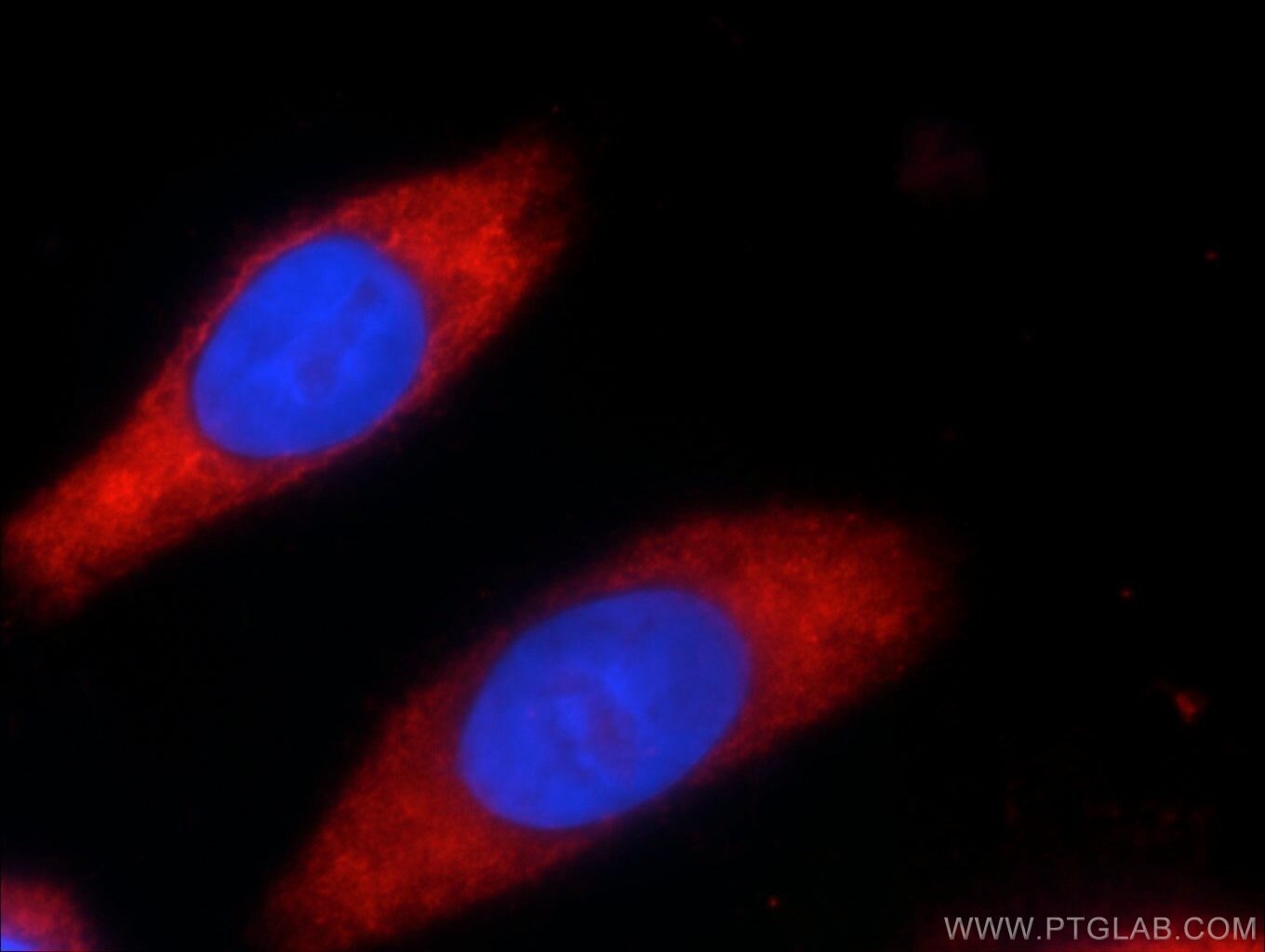 Immunofluorescence (IF) / fluorescent staining of HeLa cells using GEMIN5 Polyclonal antibody (24897-1-AP)