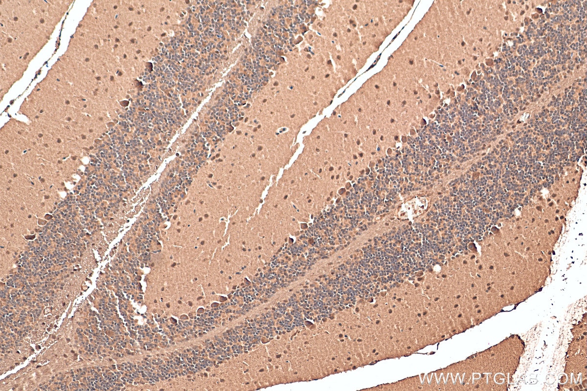 Immunohistochemistry (IHC) staining of mouse cerebellum tissue using GEMIN5 Polyclonal antibody (24897-1-AP)