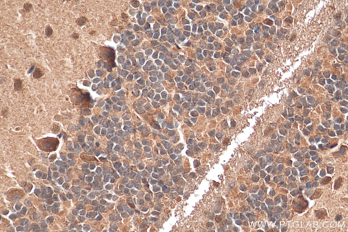 Immunohistochemistry (IHC) staining of mouse cerebellum tissue using GEMIN5 Polyclonal antibody (24897-1-AP)