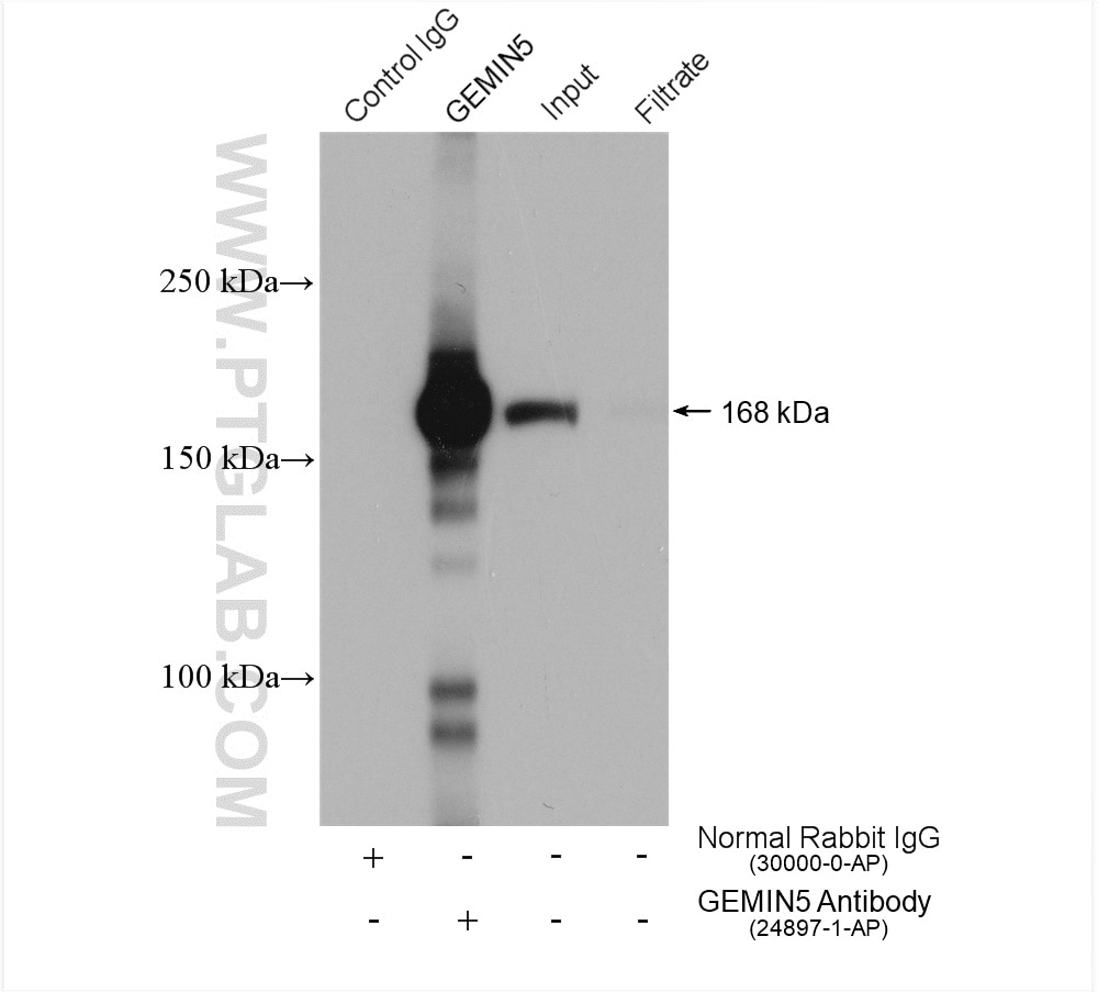 Immunoprecipitation (IP) experiment of HeLa cells using GEMIN5 Polyclonal antibody (24897-1-AP)