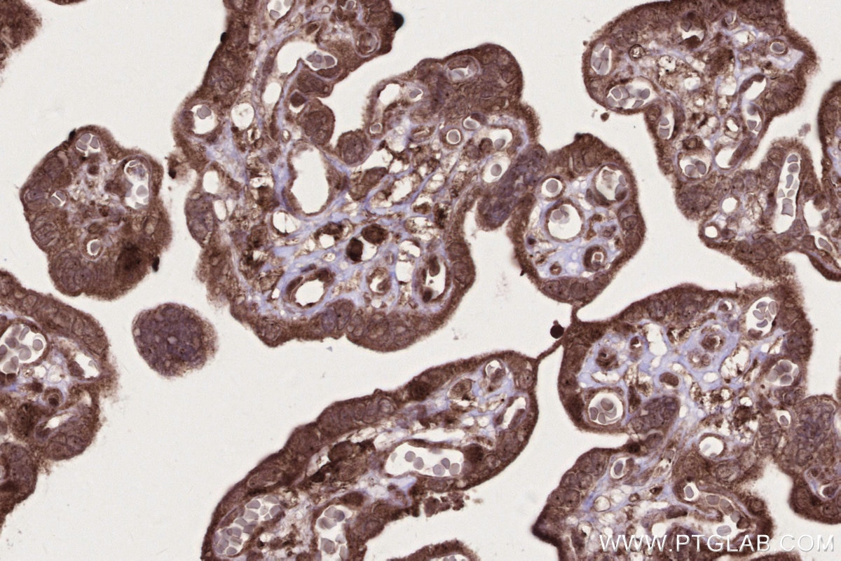 IHC staining of human placenta using 84171-5-RR Immunohistochemistry (IHC) staining of human placenta tissue using GEMIN5 Recombinant monoclonal antibody (84171-5-RR)