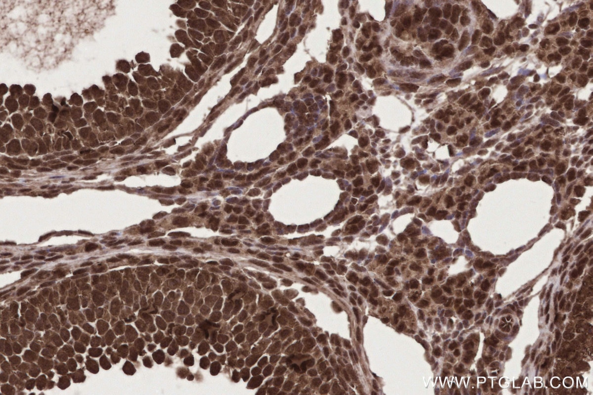 IHC staining of mouse ovary using 84171-5-RR Immunohistochemistry (IHC) staining of mouse ovary tissue using GEMIN5 Recombinant monoclonal antibody (84171-5-RR)