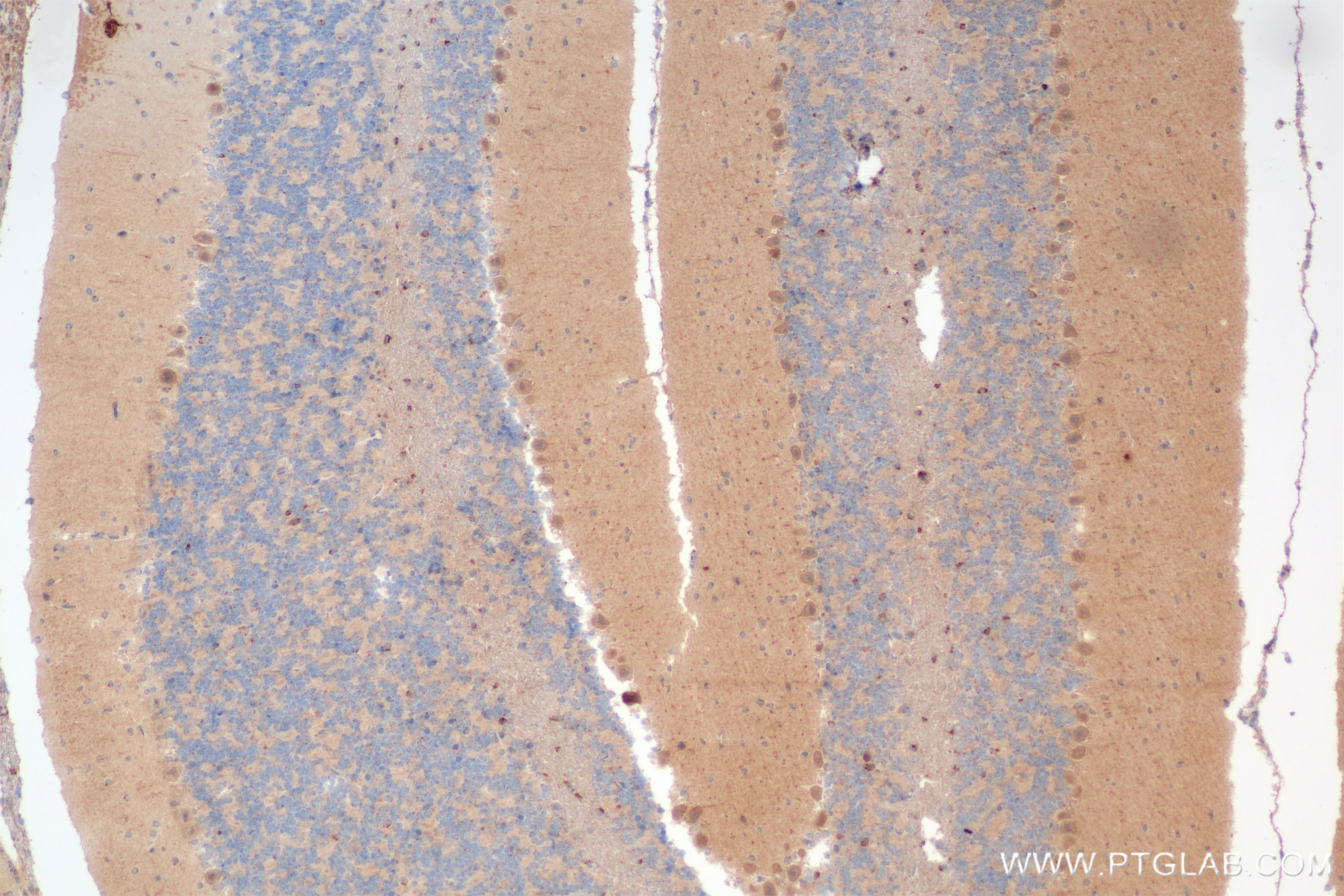 Immunohistochemistry (IHC) staining of mouse cerebellum tissue using GEMIN5 Recombinant antibody (84171-5-RR)