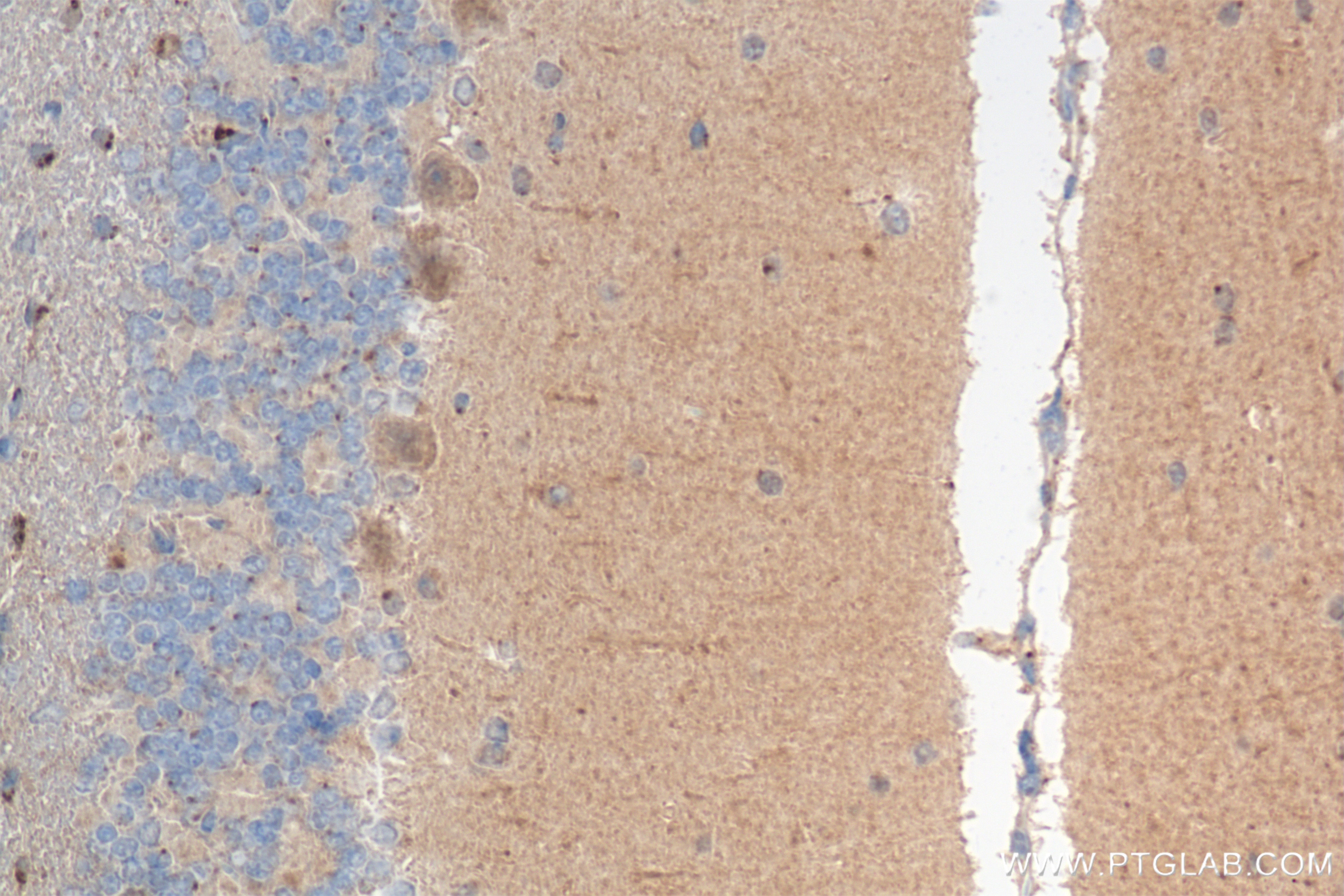 Immunohistochemistry (IHC) staining of mouse cerebellum tissue using GEMIN5 Recombinant antibody (84171-5-RR)