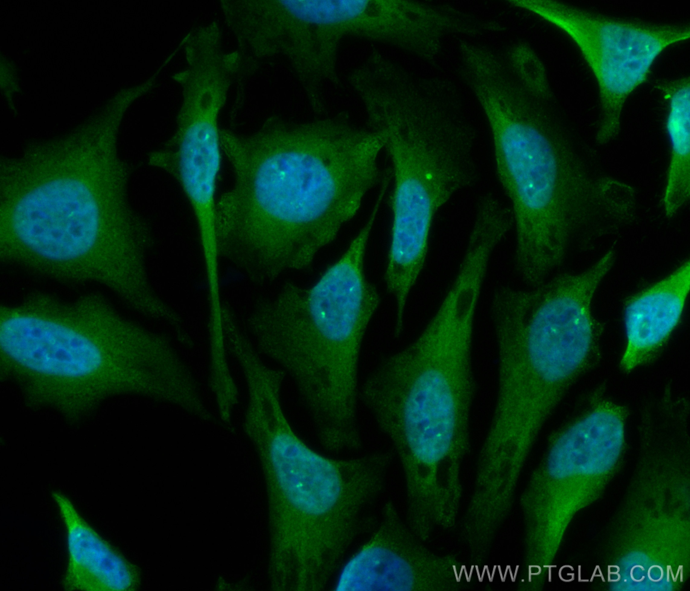 Immunofluorescence (IF) / fluorescent staining of HeLa cells using CoraLite® Plus 488-conjugated GEMIN5 Polyclonal an (CL488-24897)