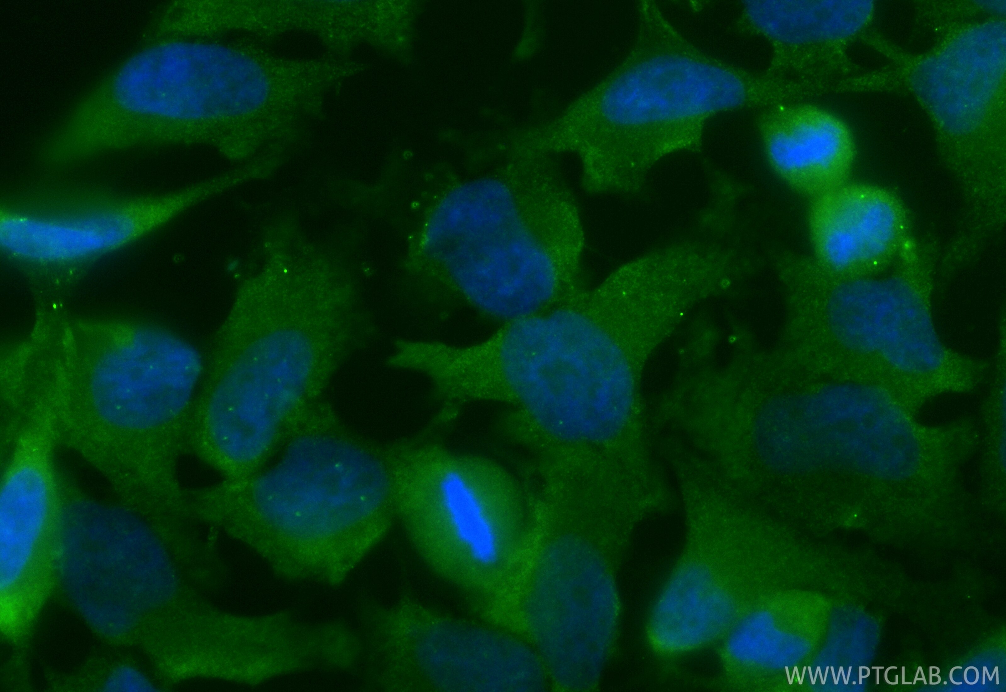 Immunofluorescent analysis of (4% PFA) fixed HeLa cells using CoraLite® Plus 488 GEMIN5 antibody (CL488-84171-5, Clone: 241205G7 ) at dilution of 1:200. Immunofluorescence (IF) / fluorescent staining of HeLa cells using CoraLite® Plus 488-conjugated GEMIN5 Recombinant m (CL488-84171-5)