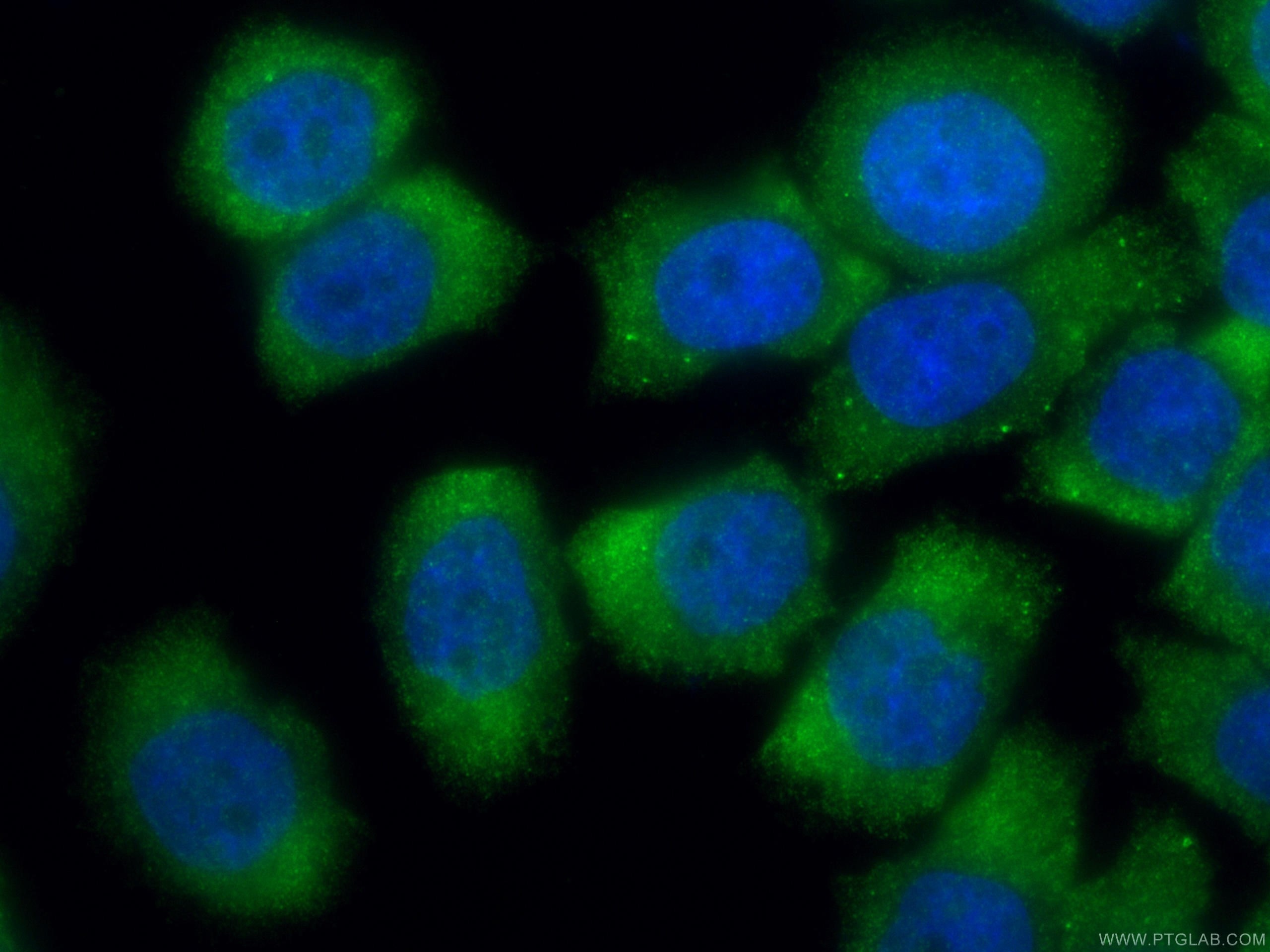 Immunofluorescence (IF) / fluorescent staining of PC-3 cells using GEMIN6 Polyclonal antibody (12307-2-AP)