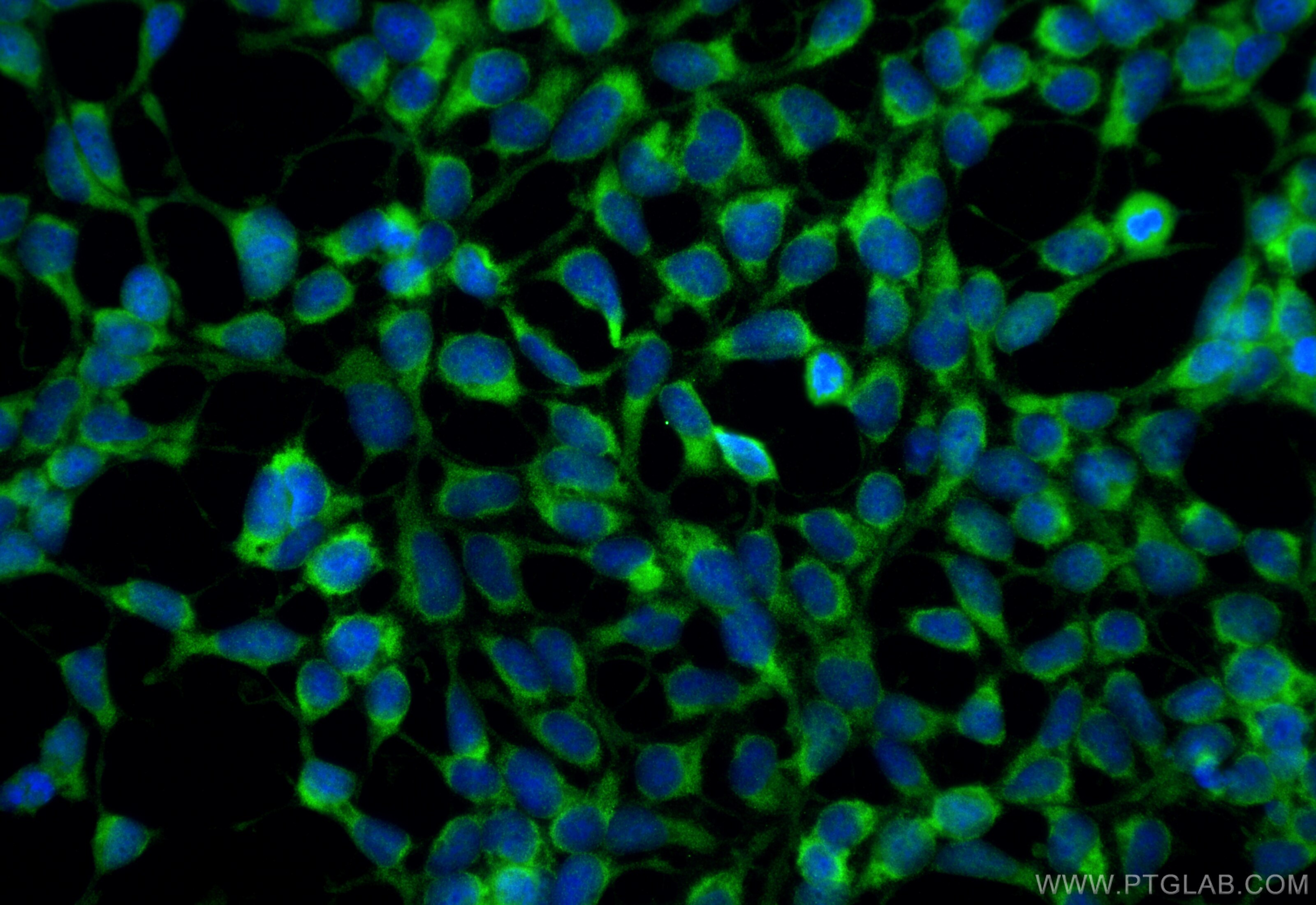Immunofluorescence (IF) / fluorescent staining of HEK-293 cells using GEMIN6 Polyclonal antibody (12307-2-AP)