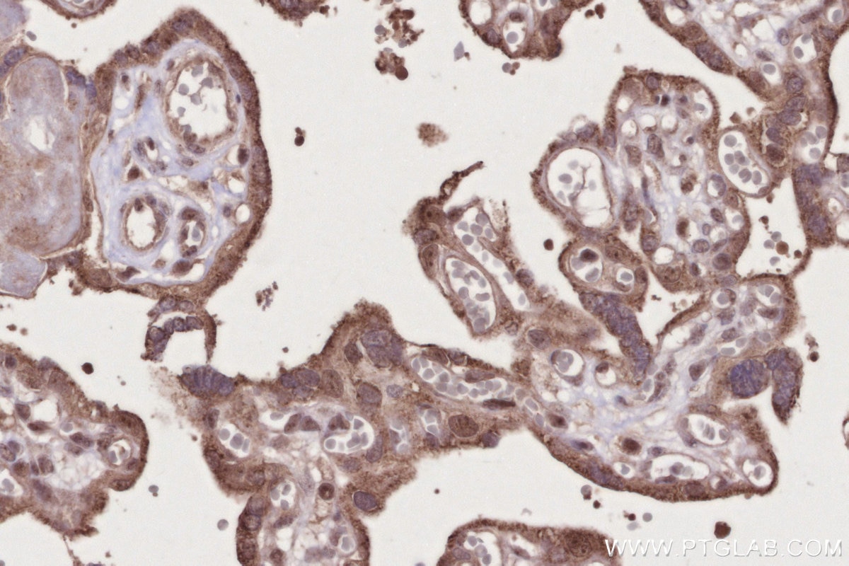 Immunohistochemistry (IHC) staining of human placenta tissue using GEMIN6 Polyclonal antibody (12307-2-AP)