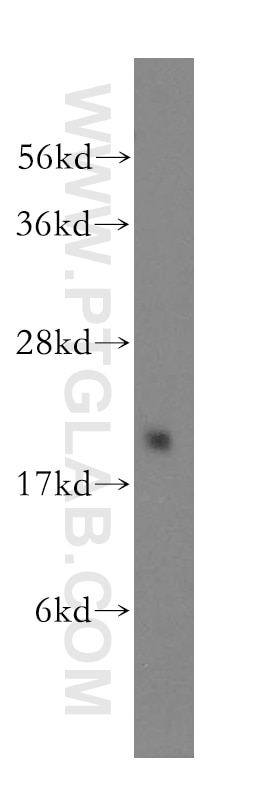 GEMIN6 Polyclonal antibody